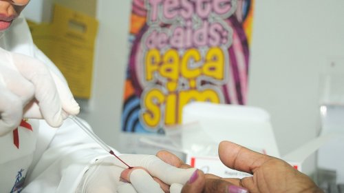 [Brasil tem redução de 5,2% na taxa de detecção de casos de aids, diz ministério]