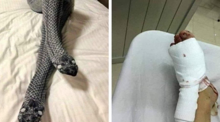 [Após usar meia-calça de “cobra”, mulher assusta marido, leva pauladas e vai parar no hospital]