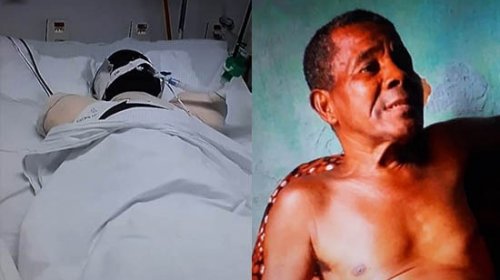 [Morre idoso que foi atacado por cães da raça pit bull em Alagoinhas]