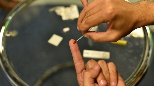 [Prefeitura inicia distribuição de autoteste gratuito para HIV]