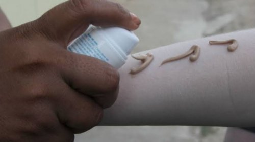 [Prefeitura oferece protetor solar para albinos e portadores de lúpus em Salvador]