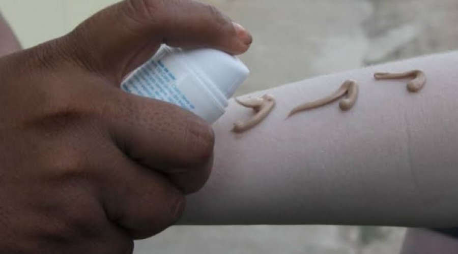 [Prefeitura oferece protetor solar para albinos e portadores de lúpus em Salvador]