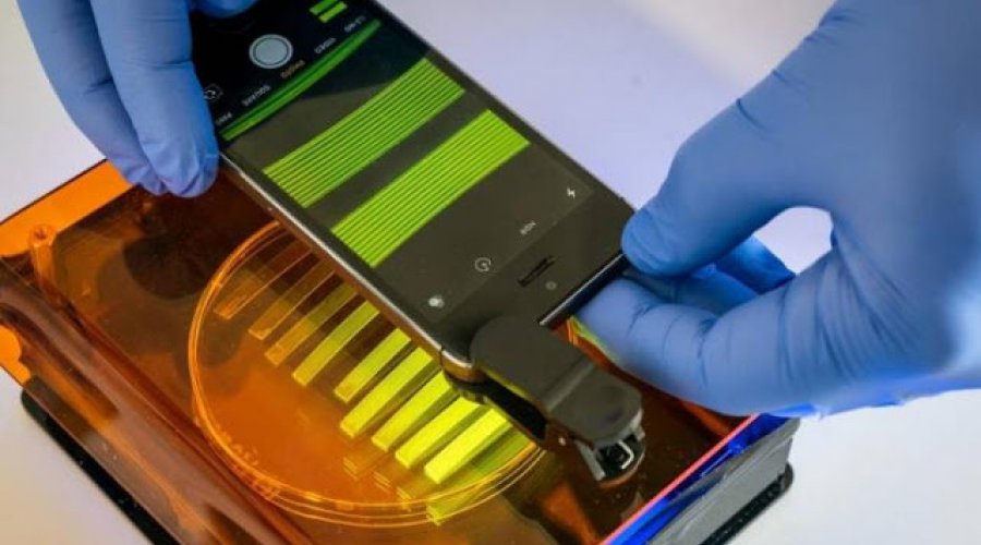 [Cientistas criam tecnologia que identifica infecção urinária com uso de smartphone]