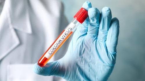 [Médico é diagnosticado com coronavírus após atender um dos primeiros casos na Bahia]