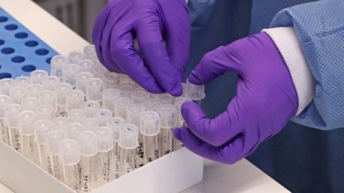 [Bahia registra 123 casos confirmados de Covid-19]