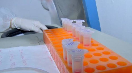 [Atualização: Bahia tem 401 casos confirmados de Covid-19 e 63 pessoas curadas]