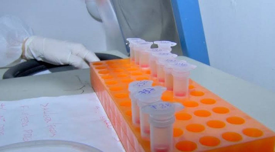 [Atualização: Bahia tem 401 casos confirmados de Covid-19 e 63 pessoas curadas]