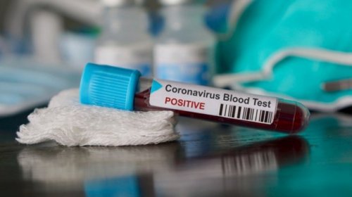[A Bahia registra 674 casos confirmados do novo coronavírus (Covid-19)]