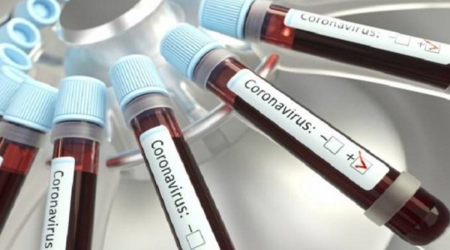 [Bahia registra 9 óbitos por Covid-19 em 24 horas]