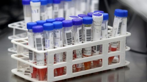 [Bahia tem 1.979 casos confirmados de Covid-19 e 67 óbitos]