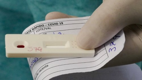 [Anvisa aprova realização de testes rápidos de coronavírus em farmácias]