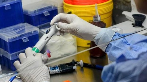 [Bahia registra 4.466 casos confirmados de Covid-19 e 161 óbitos]