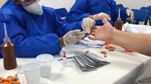 [Câmara realiza testes rápidos para o Coronavírus em funcionários]
