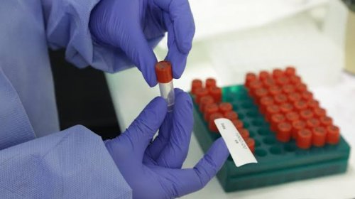 [Coronavírus: Bahia registra 399 mortes e ultrapassa 12 mil casos confirmados]