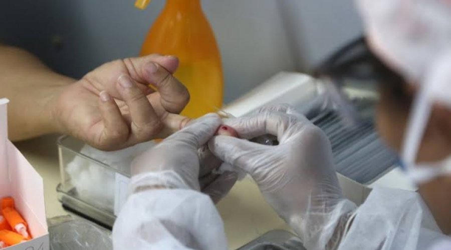 [Bahia registra 2.867 casos de Covid-19 nas últimas 24h; total chega a 101.186]
