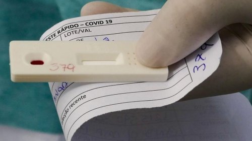 [Ministério da Saúde obriga laboratórios a notificar em até 24h resultados de testes da Covid-1...]