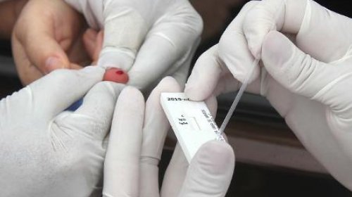 [Bahia registra 4.409 novos casos e mais 52 óbitos pela Covid-19]