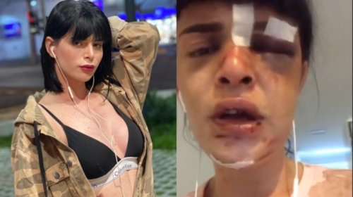 [Transexual é agredida após encontro e diz: “ele tentou me esfaquear”]