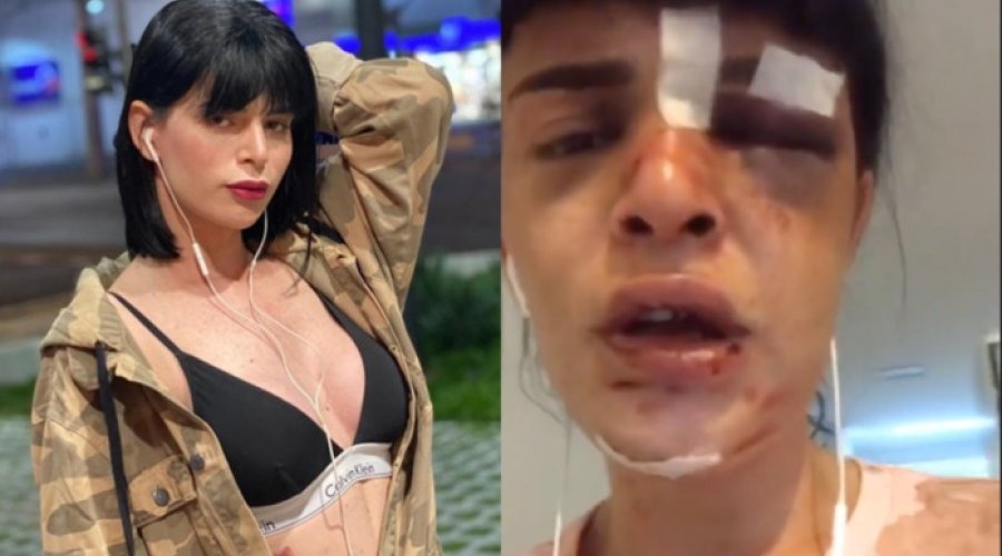 [Transexual é agredida após encontro e diz: “ele tentou me esfaquear”]