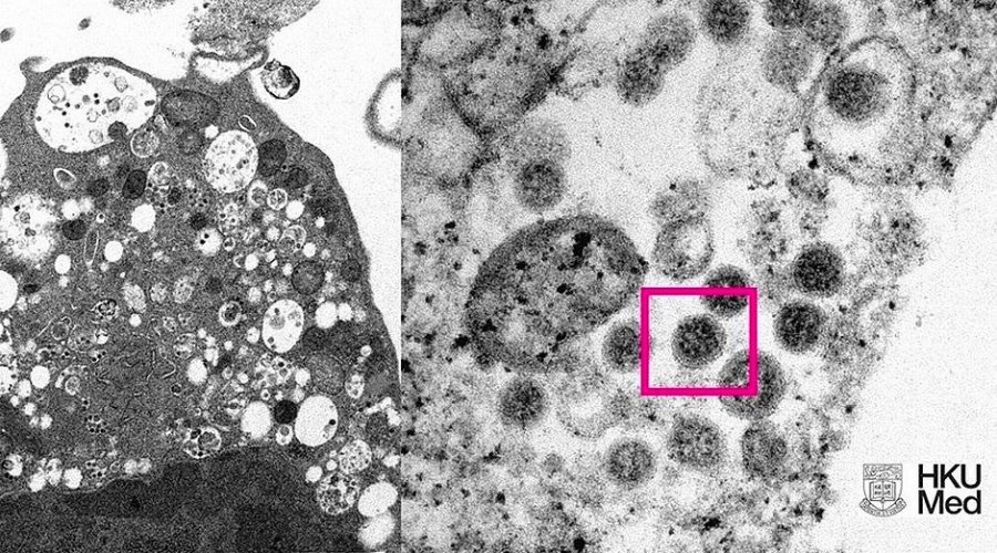 [Estudo aponta que Ômicron é variante que sobrevive por mais tempo na pele e em superfícies plásticas]