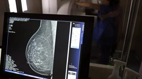 [Governo Federal aprova lei que garante fisioterapia na recuperação pós-mastectomia]