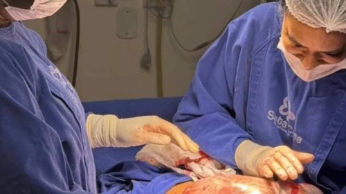 [Hospital do Recôncavo registra três nascimentos empelicados em um único dia]