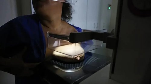 [Anvisa aprova novas formas de utilização do Trodelvy no tratamento do câncer de mama]
